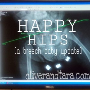 Happy Hips: A Breech Baby Update | oliverandtara.com